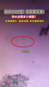 实验室放大1000倍！雨水究竟脏不脏？