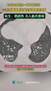 七旬老太发热一周不见好，CT检查肺部竟是家中爱宠导致。