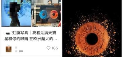 突然走红！有人开始给眼珠拍写真，医生紧急提醒