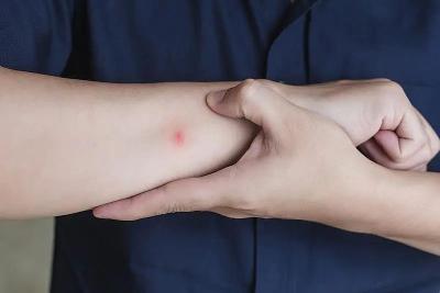 蚊子叮人也有“时间表”和“颜色偏好”？ 