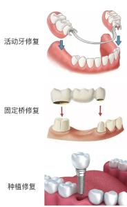口腔溃疡、牙龈肿痛……看牙该挂哪个科？这份挂号指南请收好  