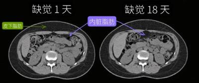 注意！缺觉，可能会让肚子长胖