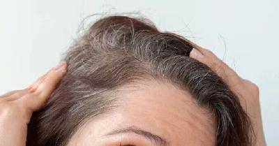 拔一根长三根，白头真的会越拔越多吗？