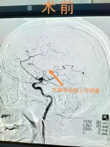 文明单位风采(108) | 市人民医院：文明优质服务，为患者打通生命通道