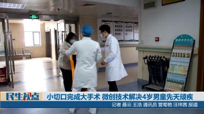 【民生视点】小切口完成大手术 微创技术解决4岁男童先天顽疾