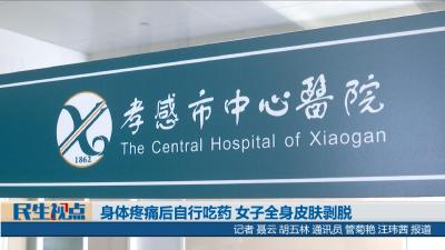 【民生视点】身体疼痛后自行吃药 女子全身皮肤剥脱