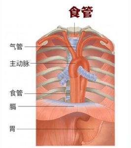 鱼刺卡喉吞饭团竟差点刺破主动脉！胃镜下精准施救化险为夷
