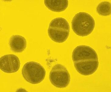 细菌超标！电饭煲“保温”不要超过4小时