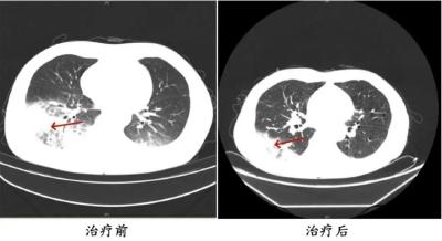 高温季即将开启 开空调前别忘做好这一步