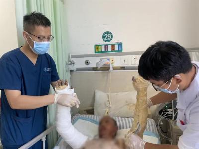 点火做个饭，小两口全身超重度烧伤
