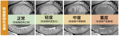 儿童眼疾频发 爱尔眼科为家长敲响警钟‌