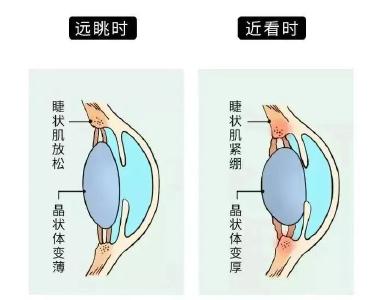 视力仅剩0.1，只因用了它……很多人家里都有