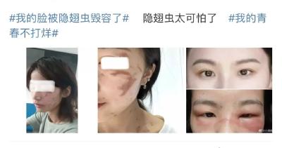 遇见它，千万不要用手拍！